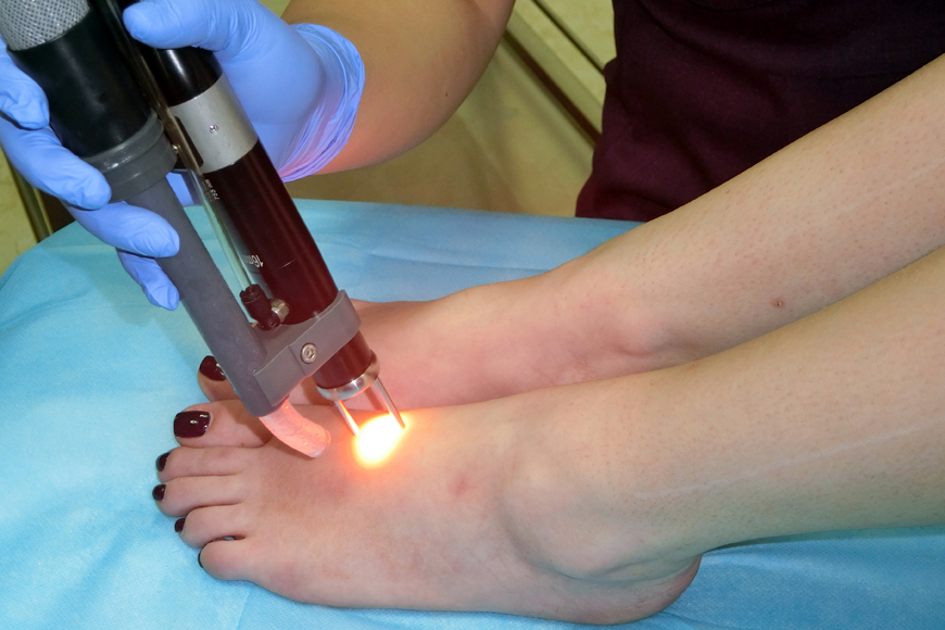 Review: Laser Hair Removal in Dubai Review: Laser Hair Removal in Dubai