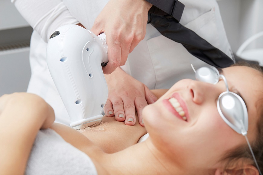 Laser Hair Removal Sessions Laser Hair Removal Sessions